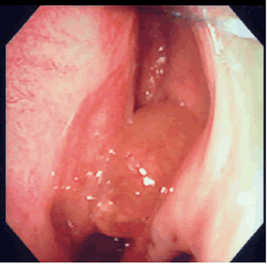 �@���F�͂Ȃ����A�|���[�v�F�摜